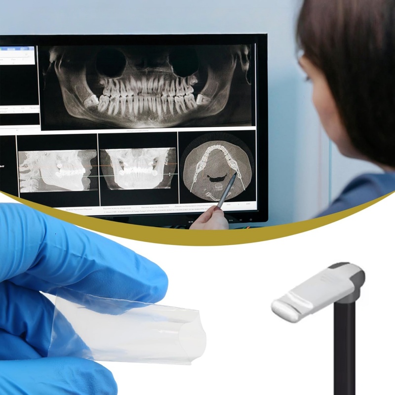200 Pezzi/Scatola Coperture Pr - Photography Dental recensione e prezzo
